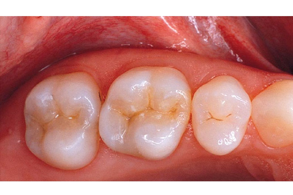 Slide 1