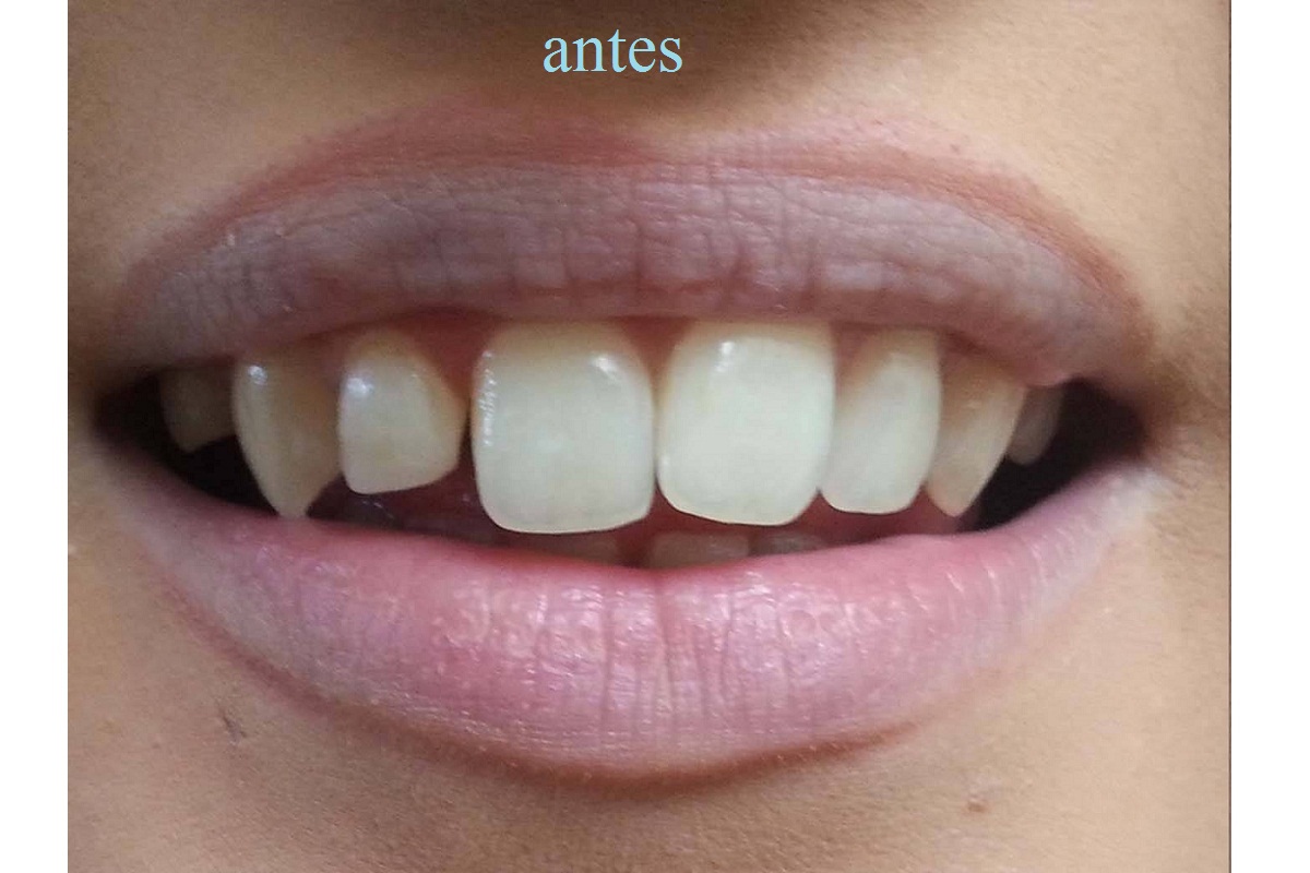 Slide 2