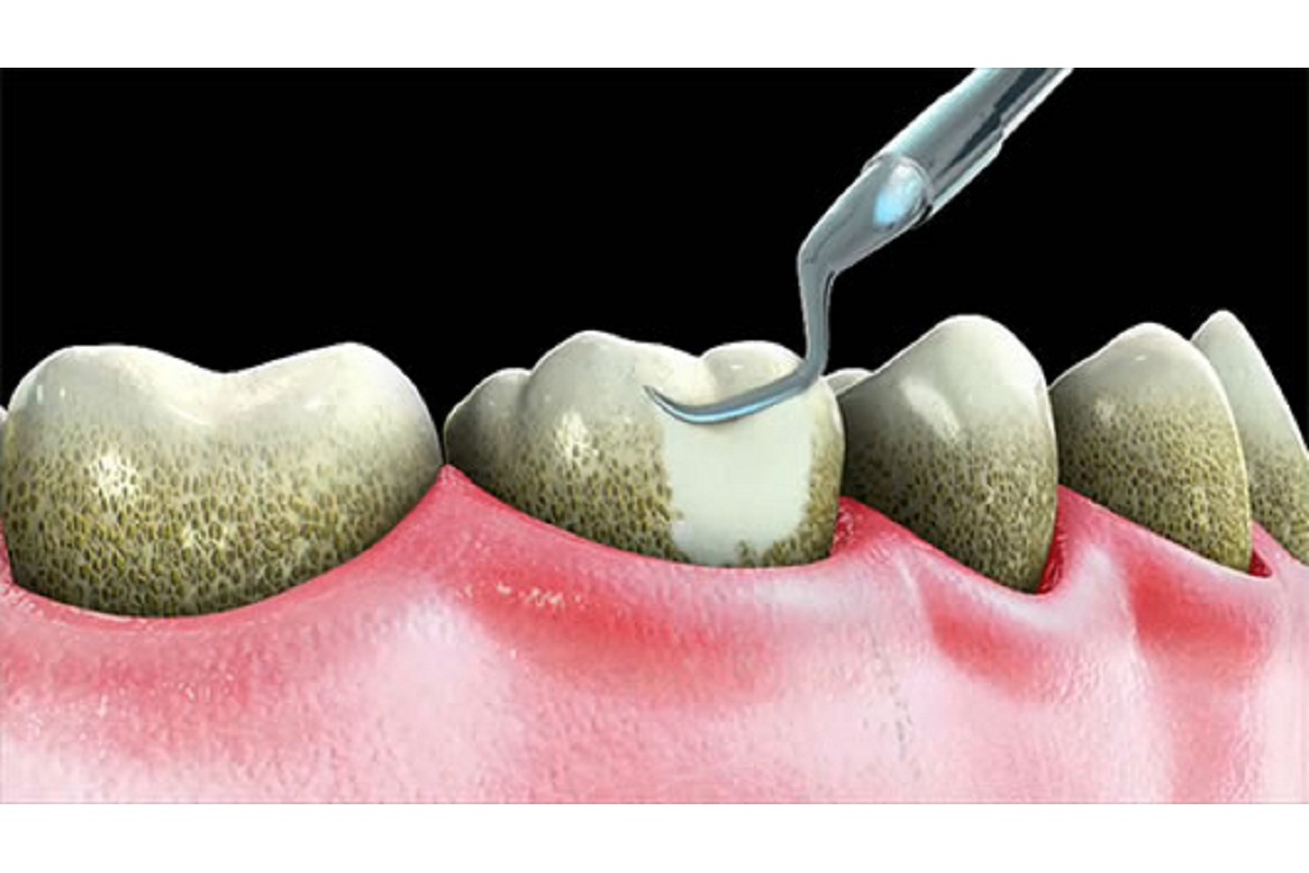 Slide 3