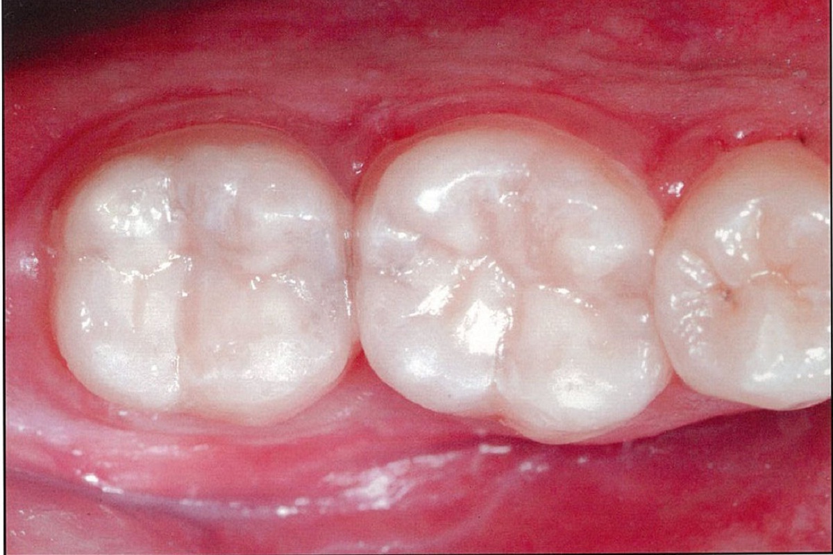 Slide 2